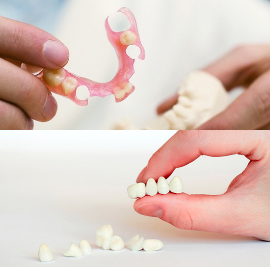 Съемные и несъемные протезы